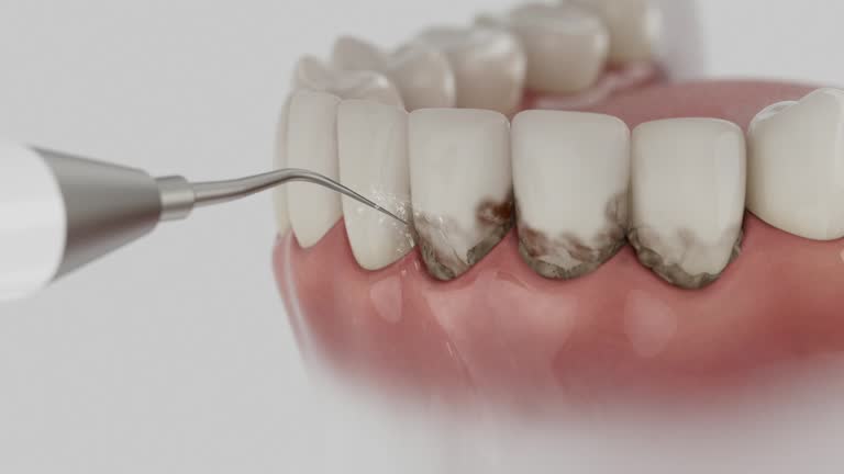 Reliable Dental contractor in Baldwin, NY by Smile Center Dentistry